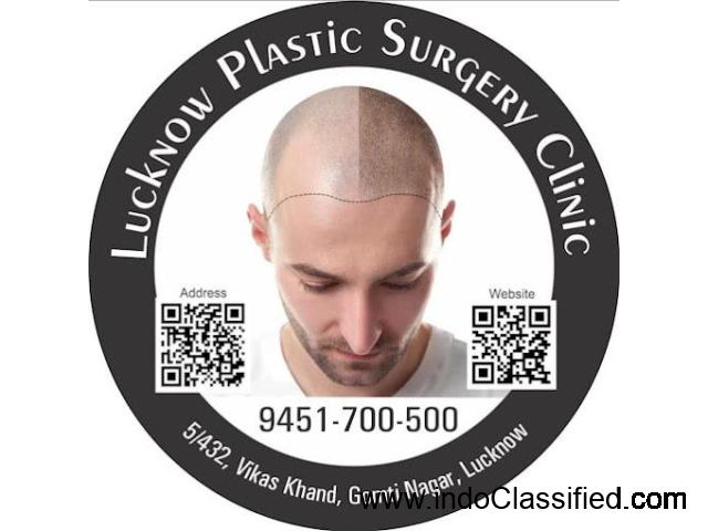 Hair Transplant in Lucknow | Plastic Surgeon in Lucknow