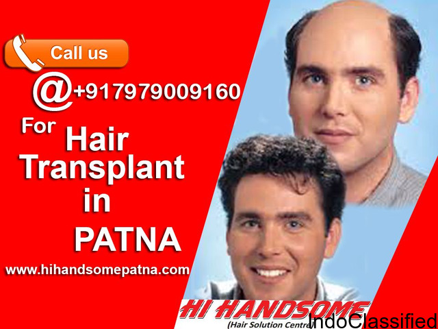 Best Hair Wig Clinic in Patna | Hair Patch Solution in Patna - Hi Handsome