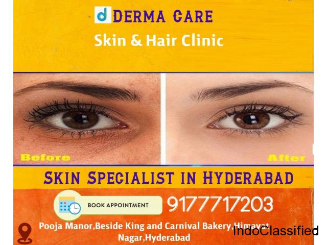 Skin Specialist in Hyderabad | Skin Whitening Treatment in Himayat Nagar