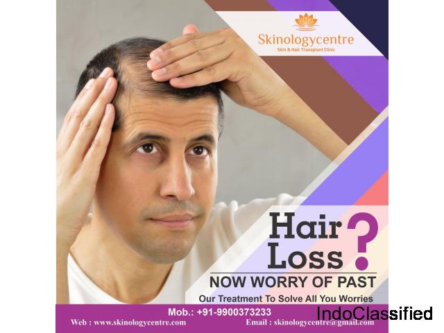 Best Hair Transplant Centre / Clinic in Bangalore – Skinology Centre