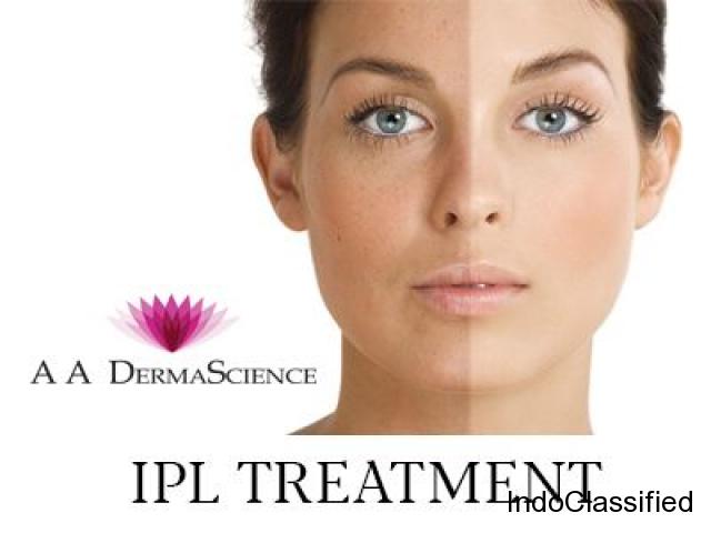 IPL Treatment - Derma Science Dermatology Clinic - 1